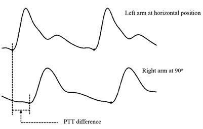 Variation of peripheral pulse transit time with internal vascular pressure changes induced by arm movement